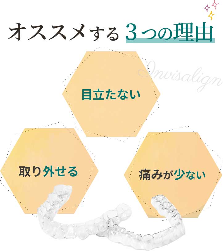 オススメする3つの理由