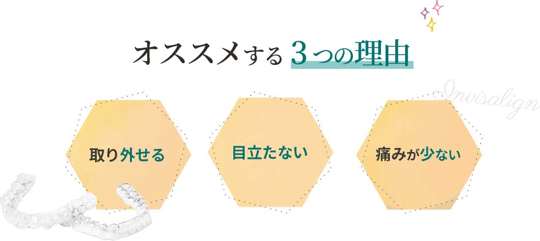 オススメする3つの理由