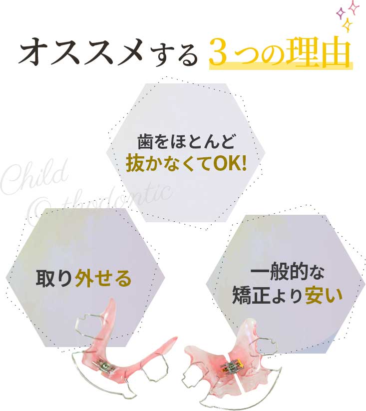 オススメする3つの理由