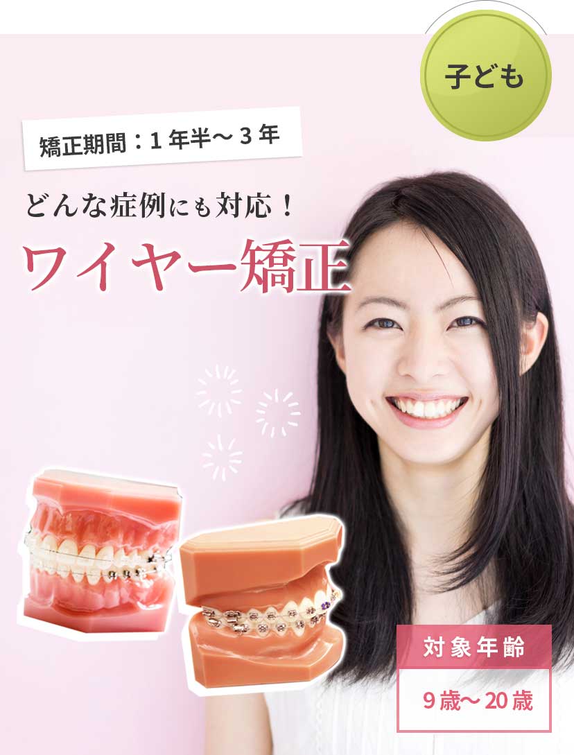 どんな症例にも対応！ワイヤー矯正