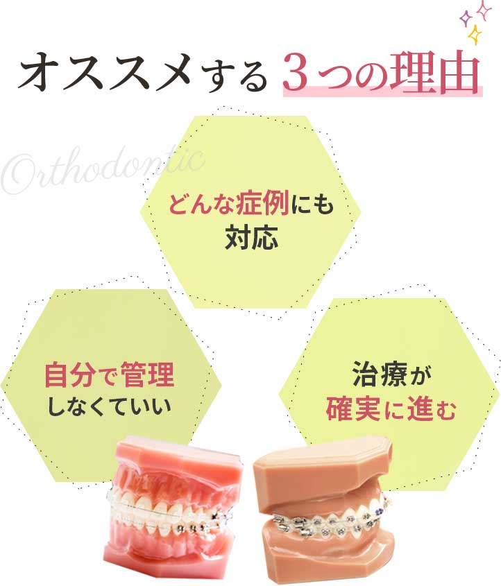 オススメする3つの理由